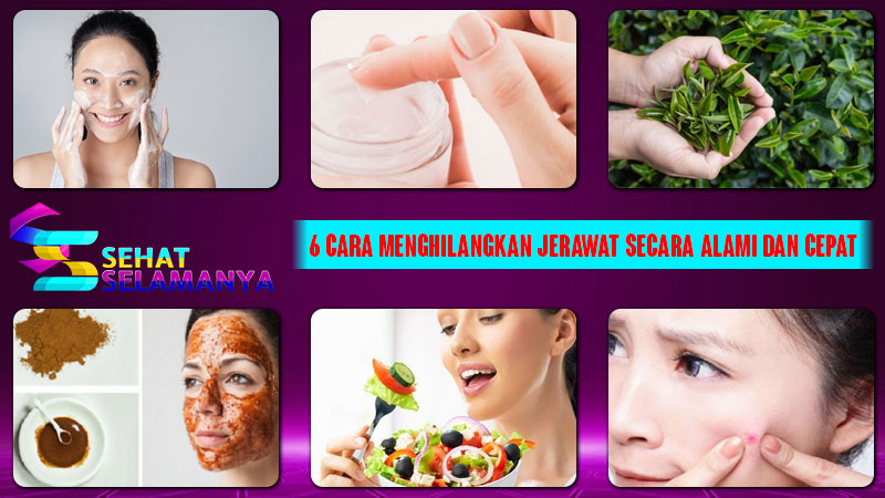 6 Cara Menghilangkan Jerawat secara Alami dan Cepat