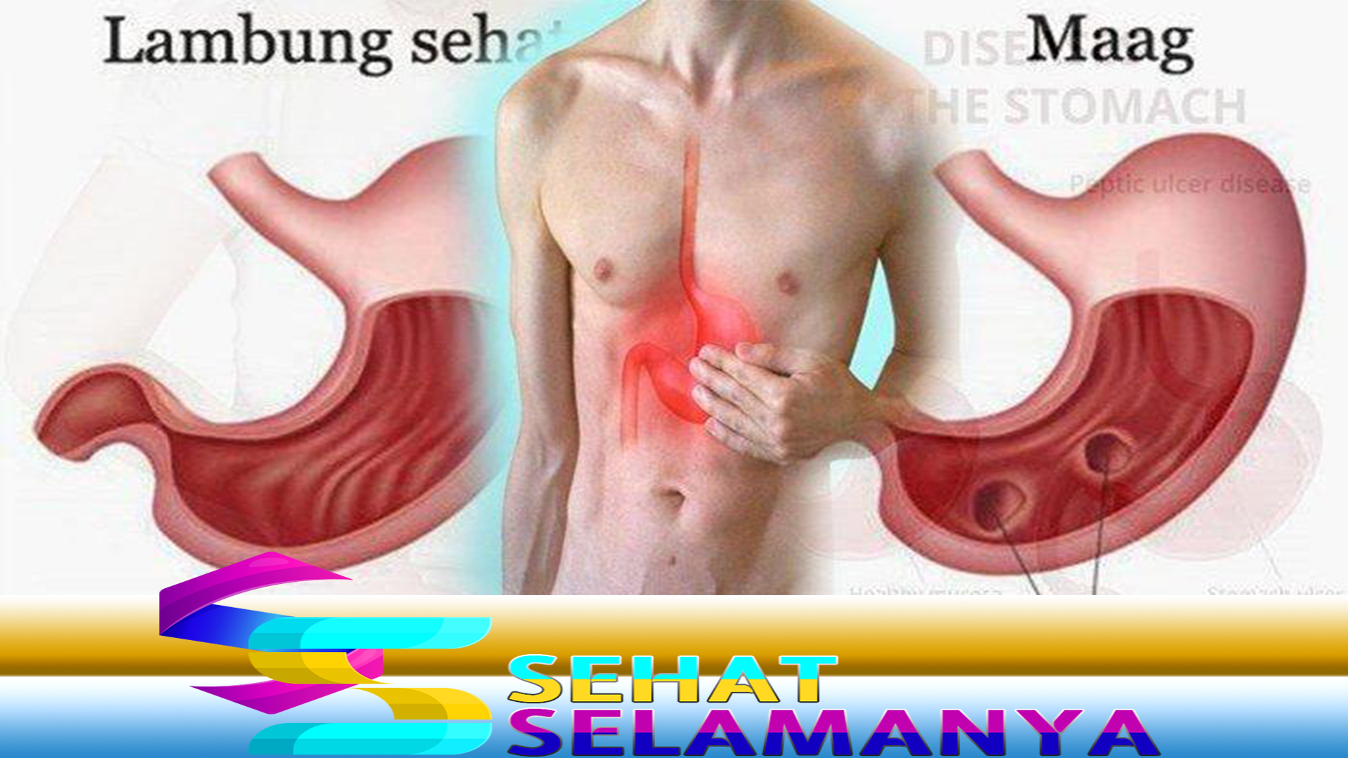 asam lambung