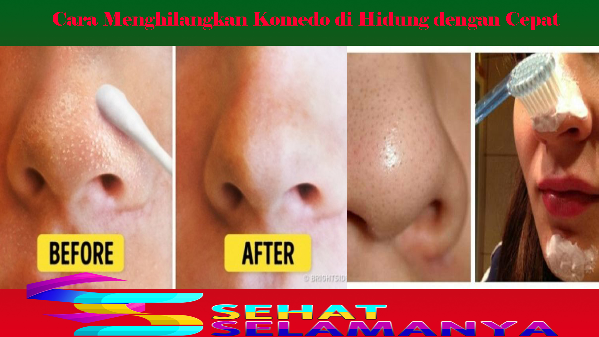 Cara Menghilangkan Komedo di Hidung dengan Cepat