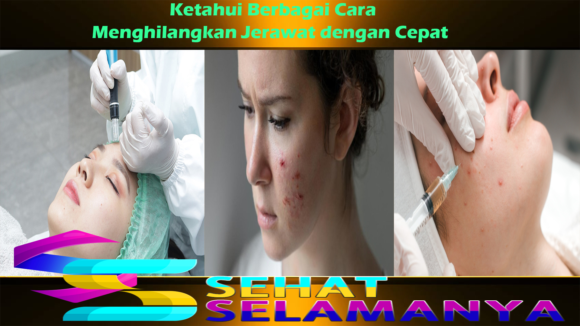 Ketahui Berbagai Cara Menghilangkan Jerawat dengan Cepat