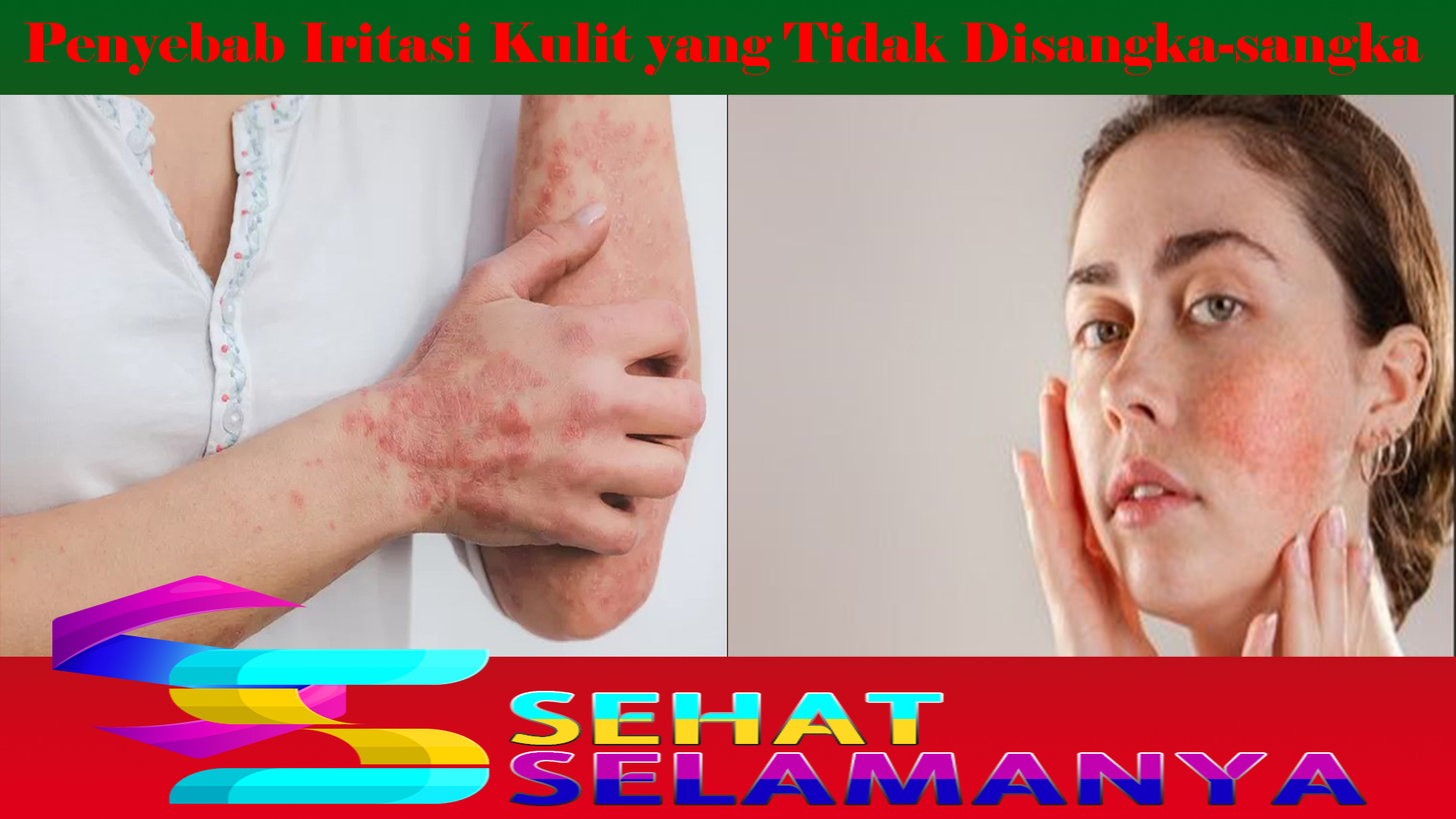 Penyebab Iritasi Kulit yang Tidak Disangka-sangka