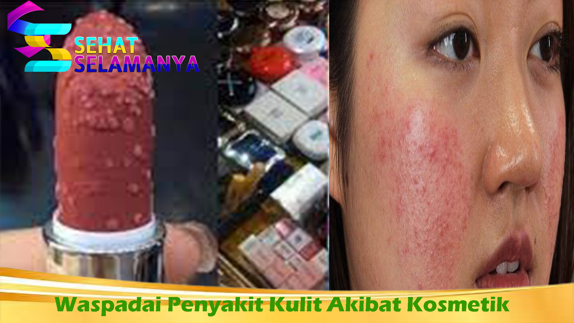 Waspadai Penyakit Kulit Akibat Kosmetik