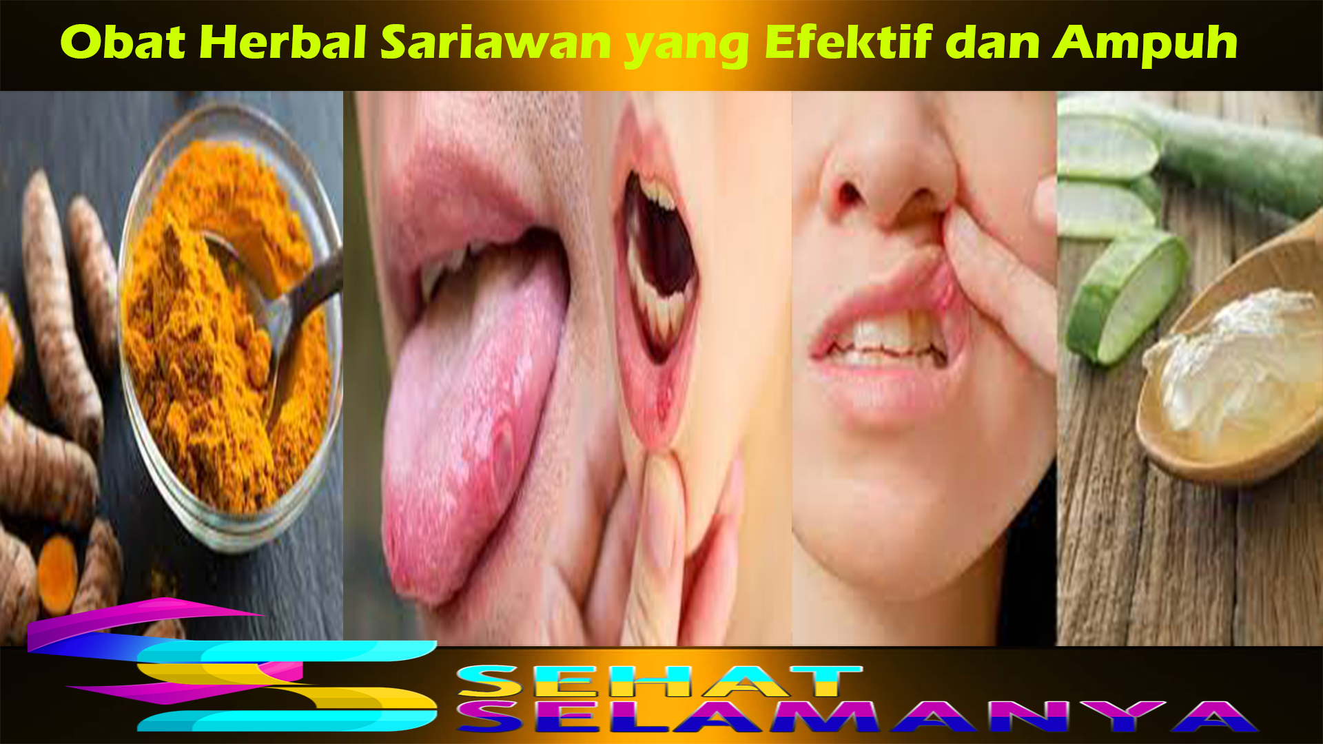 Obat Herbal Sariawan yang Efektif dan Ampuh