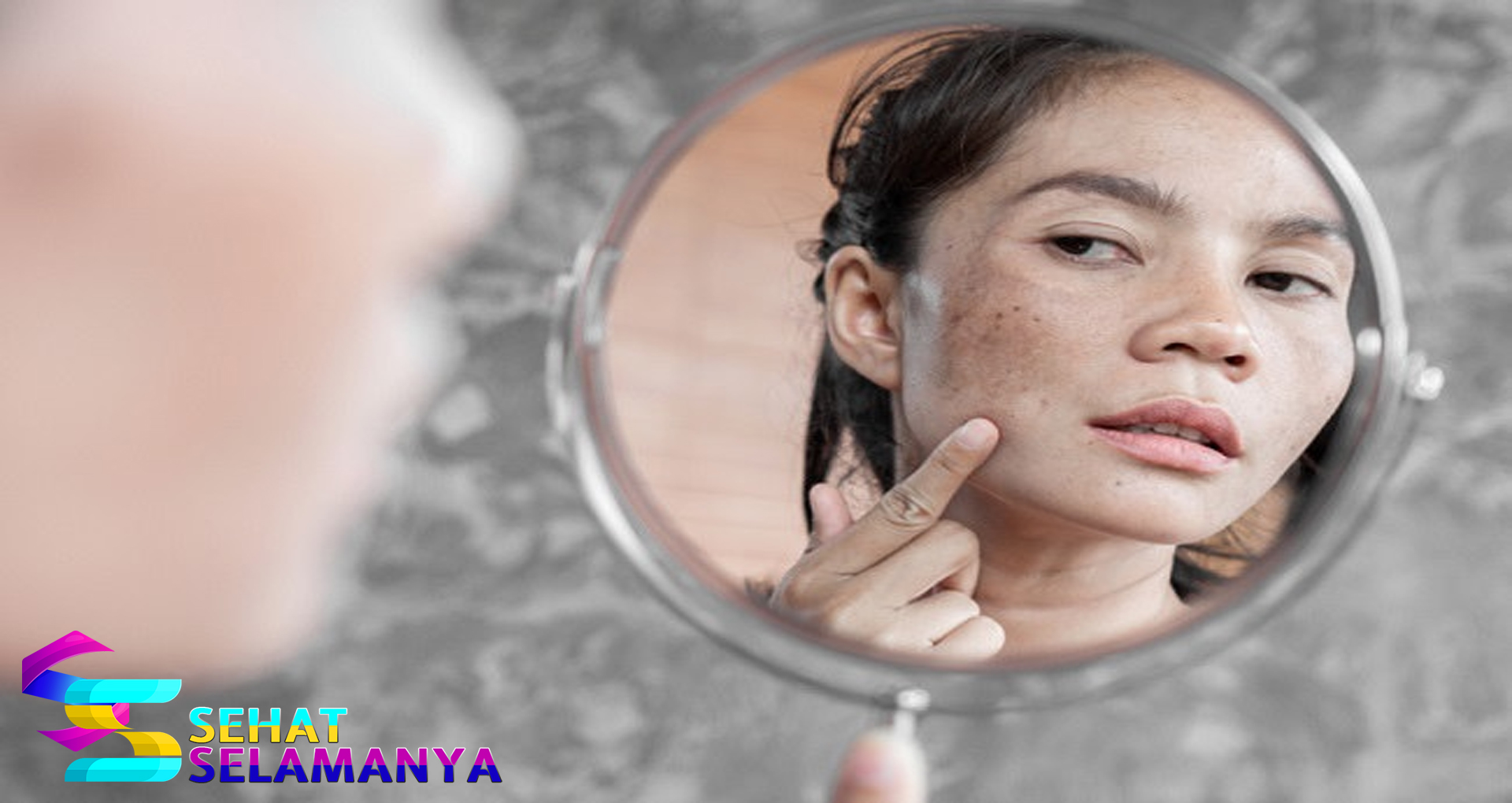 Agar Flek Hitam Tidak Muncul Lagi, Ini 6 Cara yang Bisa Dilakukan