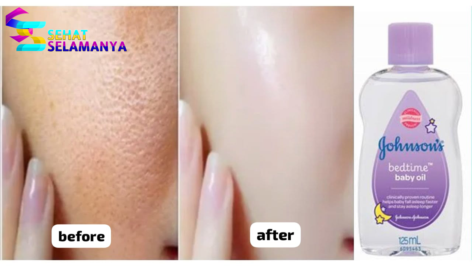 Baby Oil untuk Wajah: Banyak Manfaat dan Cara Menggunakan