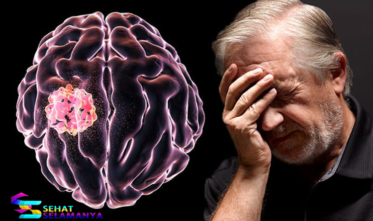 Gejala Penyakit Tumor Otak